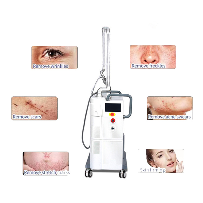 

Beauty Items tightening skin care beauty fractional co2 laser scar removal