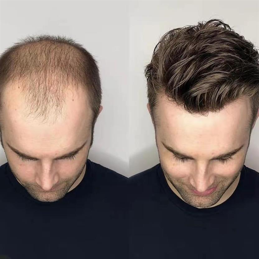 

Newest Men's Wig Super Fine Swiss Lace Men Toupee 8x10 Inches Brazilian Human Hair Prosthetic Male Wigs 263a, Natural color