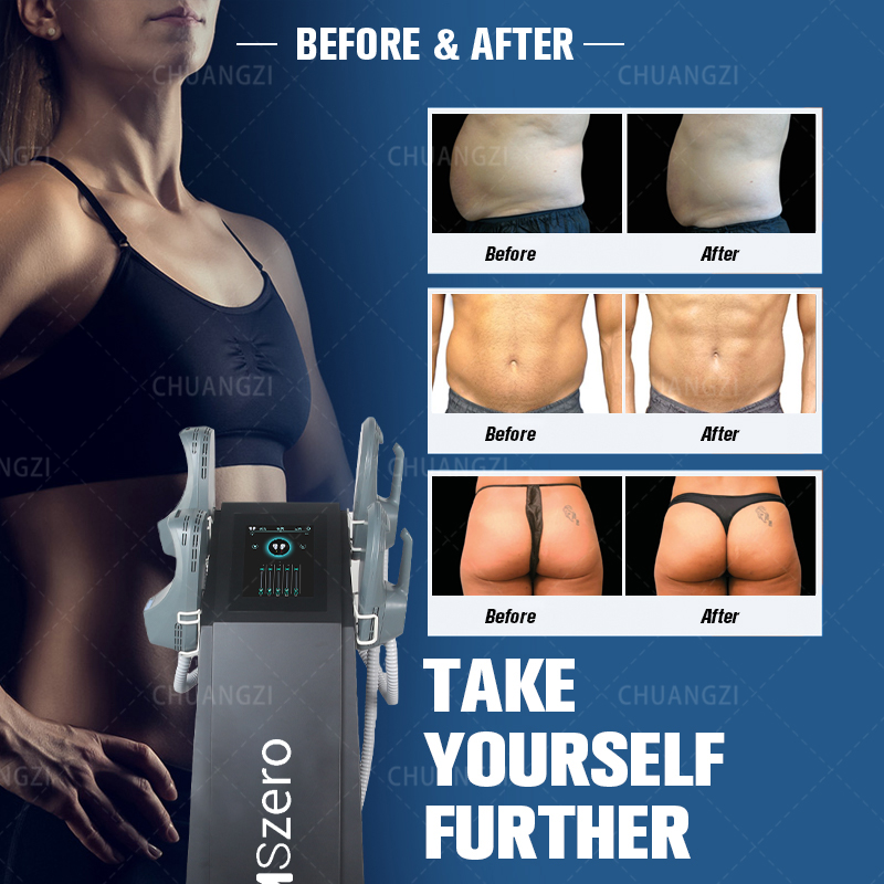 

New truly beauty Portable DLS-EMSLIM 4 handles EMSzero Muscle Stimulation Fat Burn Body Shaping Beauty Instrument Sculpt For Salon use