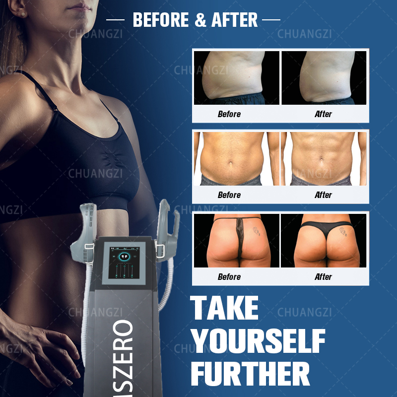 

Emslim beauty outlet Neo Fat Burn Ems Muscle Stimulator Sculpt Electromagnetic Body Contouring EMSzero Machine
