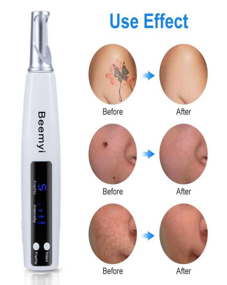 

Blue Ray Picosecond Laser Pen Scar Spot Freckle Skin Tag Removal Tattoo Melanin Diluting Machine With Protective Eyeglass Device1737555