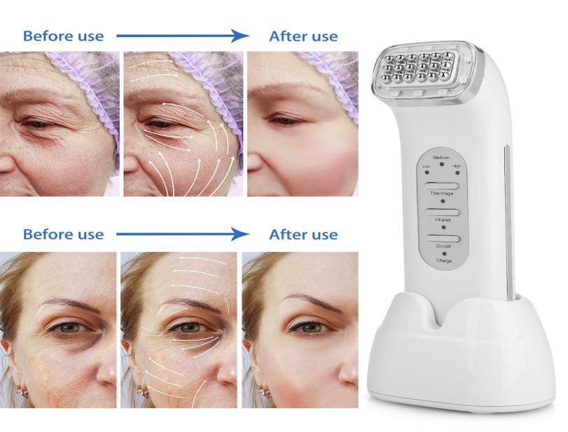 

Dot Matrix Facial RF Radio Frequency Wrinkle Removal Machine For Lifting Face Lift Body Skin Skin Tightening Skin Care Tools4804614