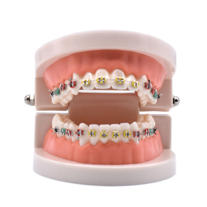 

Other Oral Hygiene Dental Orthodontic Treatment Model With Ortho Metal Ceramic Bracket Arch Wire Buccal Tube Ligature Ties Dental Tools Dentist Lab 230425