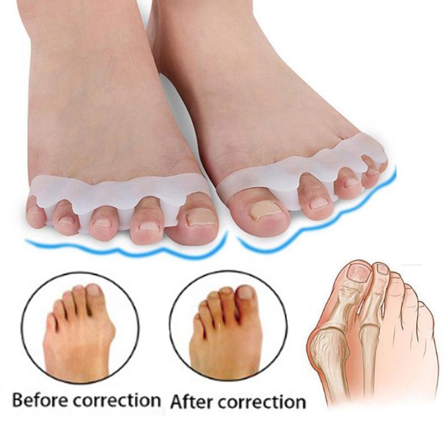 

Hallux Valgus Braces Toe Separator Overlapping Toes Rehabilitation Treatment Foot Bone Ortic Device Feet Care Silicone Gel Buni8001899