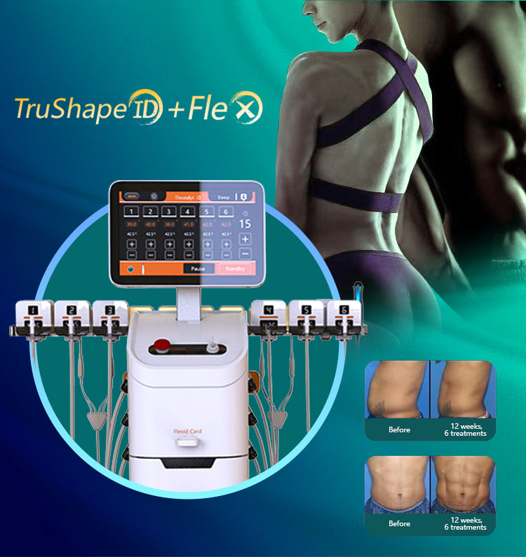 2Mhz Monopolaire Trushape Fex Body Sculpting ID Flex Trusculpt Machine de perte de poids Brûlure de graisse Resserrement de la peau Trusculpt 3d