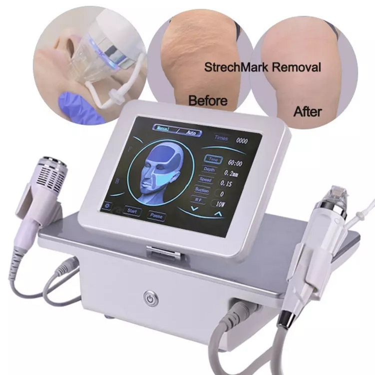 

Fractional rf microneedle machine microneedling rf beauty device for stretch marks removal acnes treatment