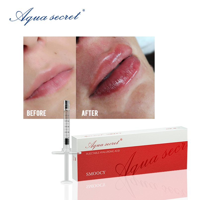 

Aqua Secret buy Beauty Items cheek injection online 1ml 2ml dermal filler ha crosslinked lip filler