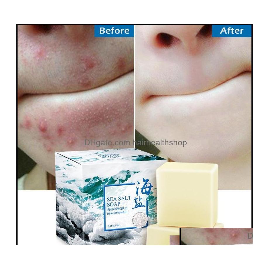 

Handmade Soap Handmade Soap Bath Body Health Beauty 100G Removal Pimple Pores Acne Treatment Sea Salt Cleaner Goat Milk Moisturizing Otv6M