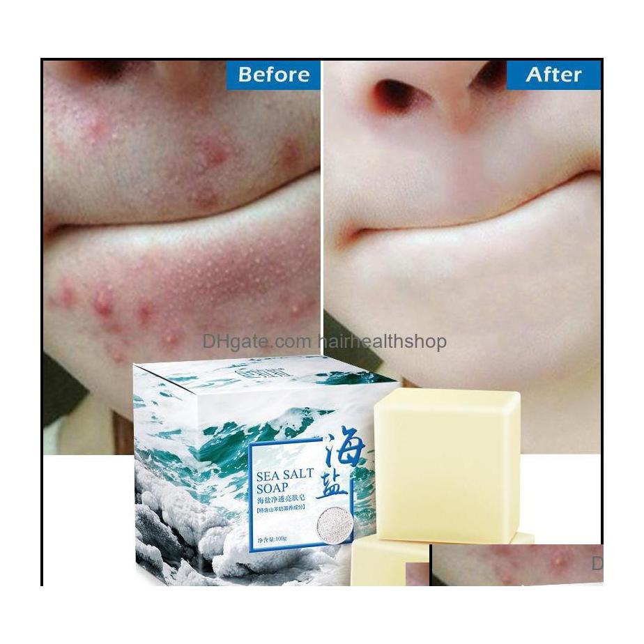 

Handmade Soap Handmade Soap Bath Body Health Beauty 100G Removal Pimple Pores Acne Treatment Sea Salt Cleaner Goat Milk Moisturizing Ot0Uy