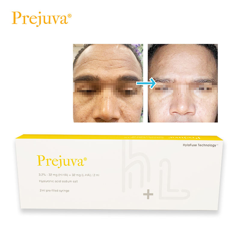 

Prejuva Profhilo 5 Point Lift Beauty Items Men Under Eye bag Filler For Bags