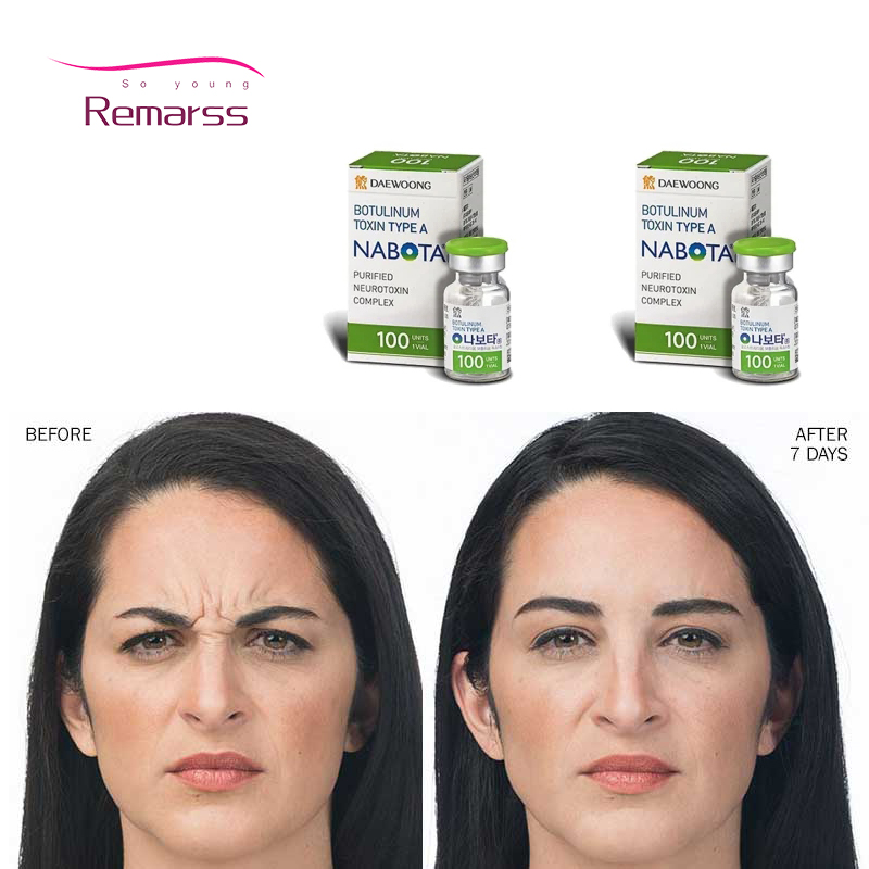 

beauty items Saline alergan botox's Botulax BTX toxins Nabota wiztox rentox INIBO novatox100U ReNtox Meditoxins botulinicas