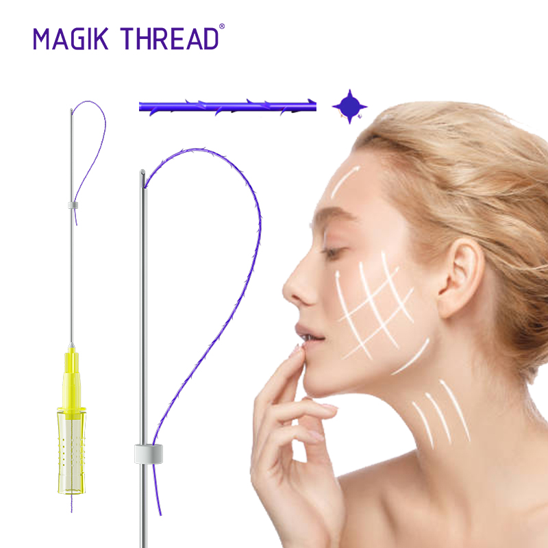 

Magik Thread Beauty Items fio 18g 100mm thread cog 4d L cannula pdo threads korean ce approved