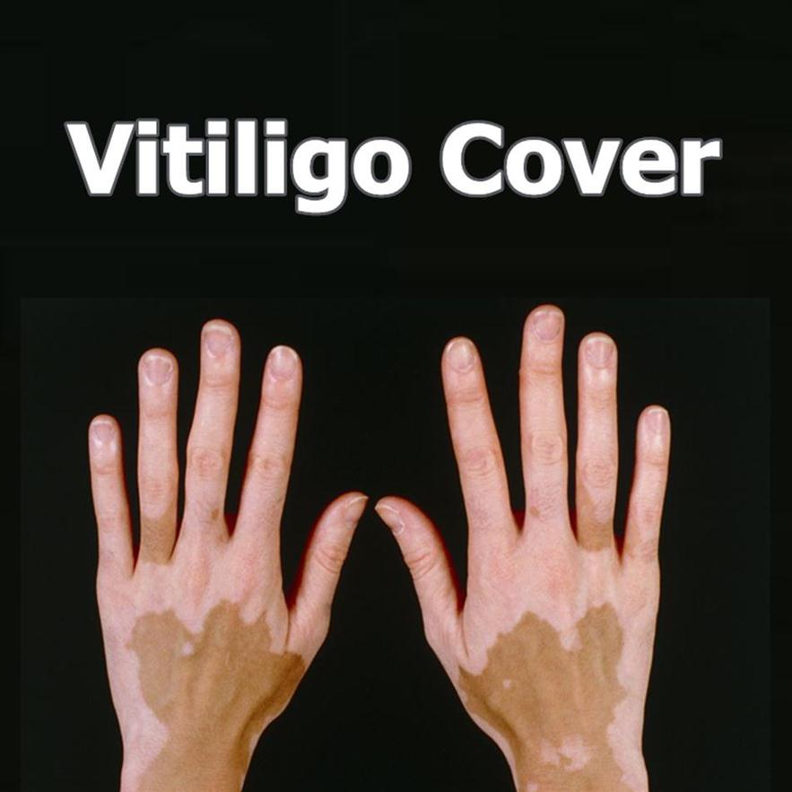 

Vitiligo Concealer Liquid Pen Waterproof Vitiligo Patches Natural Hide Leukoderma Instant Makeup Covering Solution for Skin Diseas272g275I