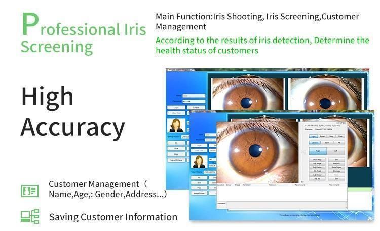2020 High definition eye analysis iridology iris photography software iriscope eye scanner