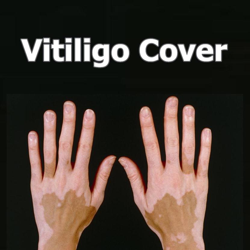 

Vitiligo Concealer Liquid Pen Waterproof Vitiligo Patches Natural Hide Leukoderma Instant Makeup Covering Solution for Skin Diseas226a232A