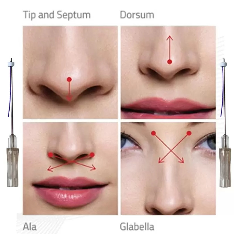 

Beauty Items korea collagen pdo thread face lift Nose Lift Cogs Skin Lifting