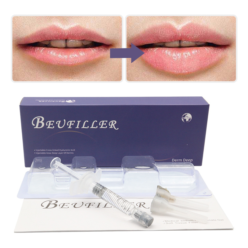 

Beauty Items beufiller 2ml lips fille nose injection juvederms