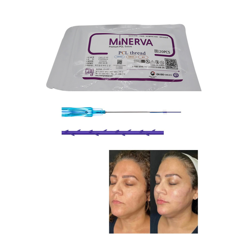 

Beauty Items MINERVA PDO COG thread for Face Lift cog 18g 19g Mono Type 29G 25MM 20pcs