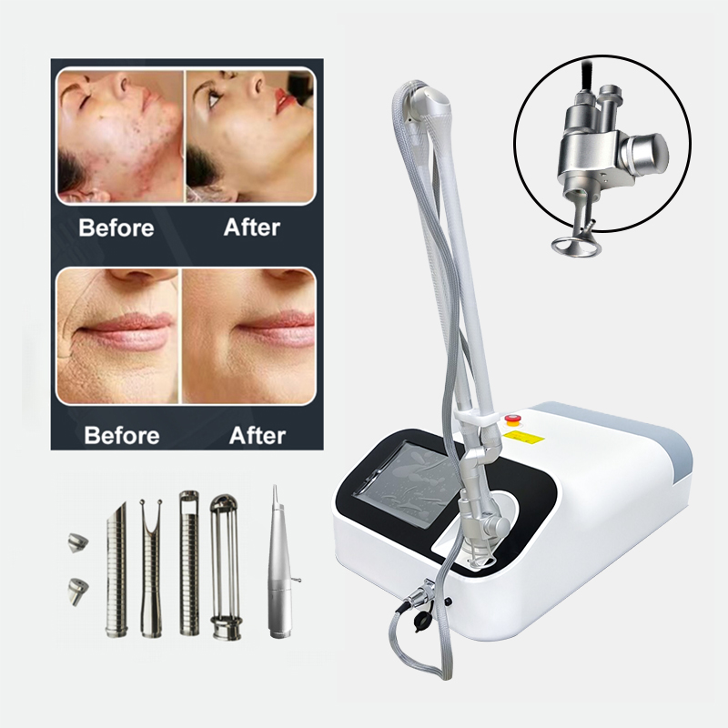 Portable CO2 Laser Fractional Beauty Machine Fraccionado Co2 Laser Professional Wrinkle Scar Removal Carbon Peeling Stretch Mark Removal Device