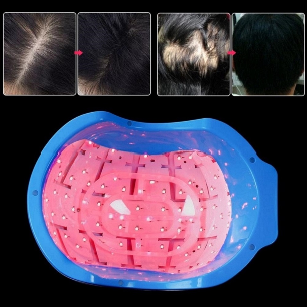 Hair Regrowth Led Laser 80 Diodes Laser Cap Massage Equipment With Red Light 678nm Laser Therapy Device Portable Home Use