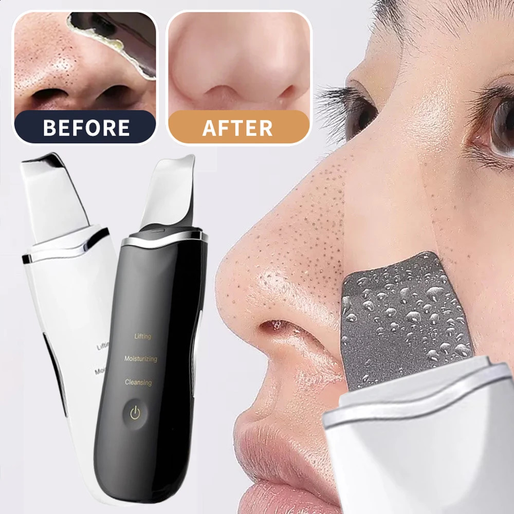 Electric Skin Scrubber Peeling Blackhead Remover Deep Face Cleaning Lifting Ion Acne Pore Cleaner Facial Spatula Shovel Cleanser 250819