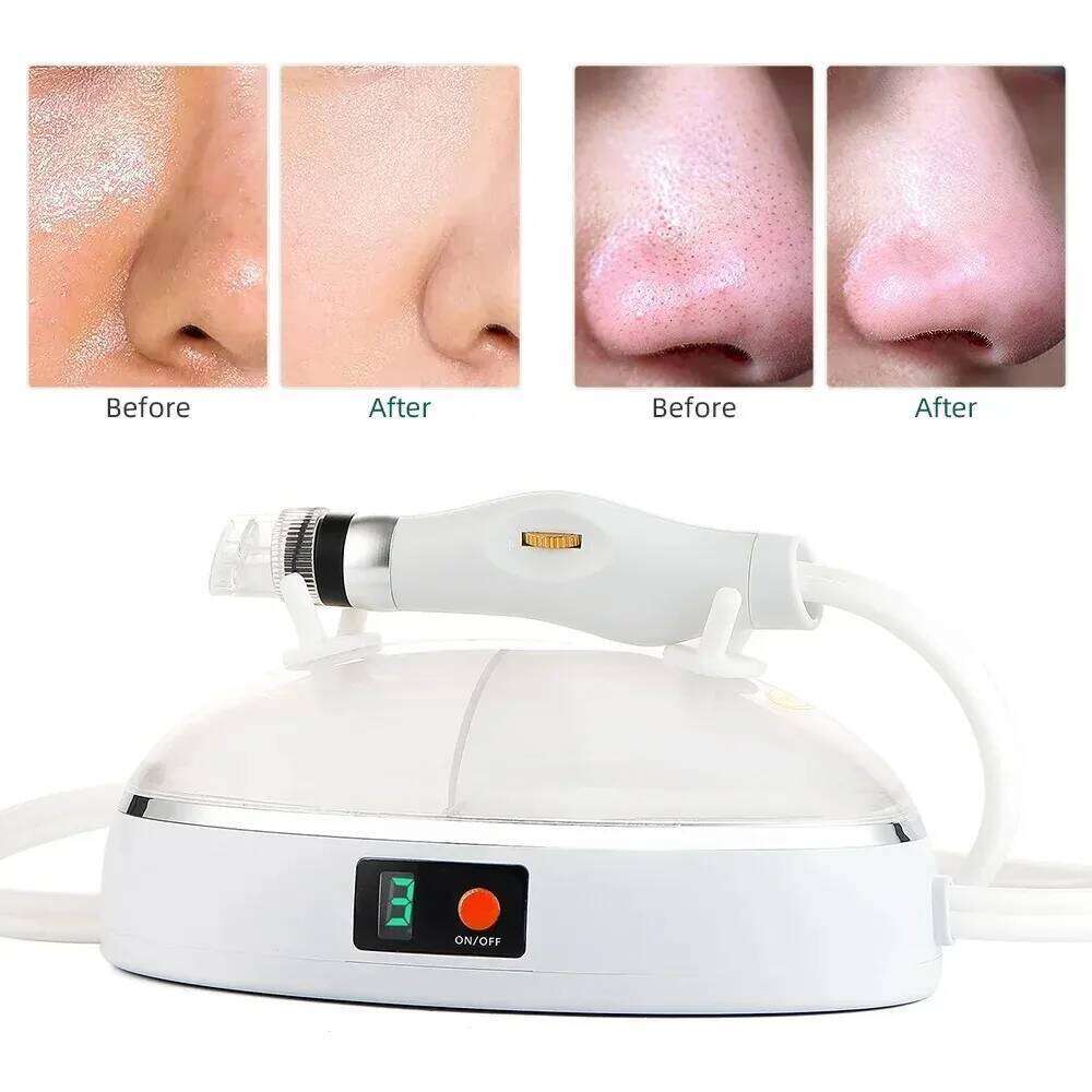 New Blackhead Remover Pore Vacuum Cleaner USB Rechargeable Oxygen Facial Hine Cleaning Jet For Home And Beauty Salon