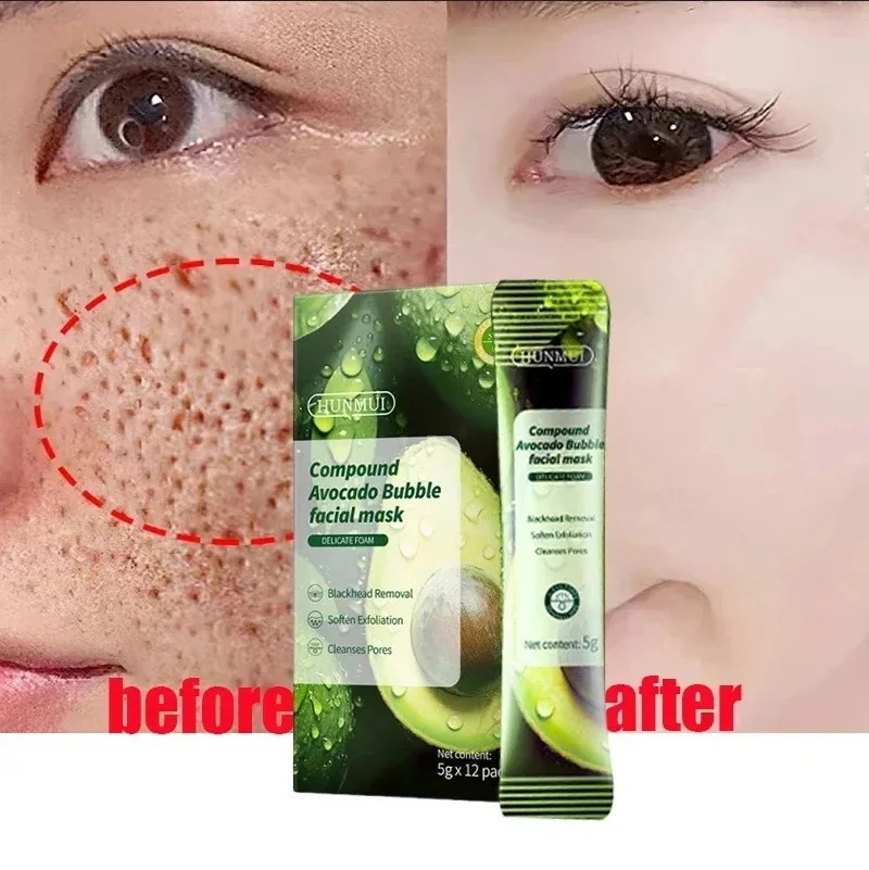 Salicylic Acid Pore Shrinking Mask Quick Elimination Large Pores Remove Blackehead Tighten Face Smooth Skin Korean Care Product 251013