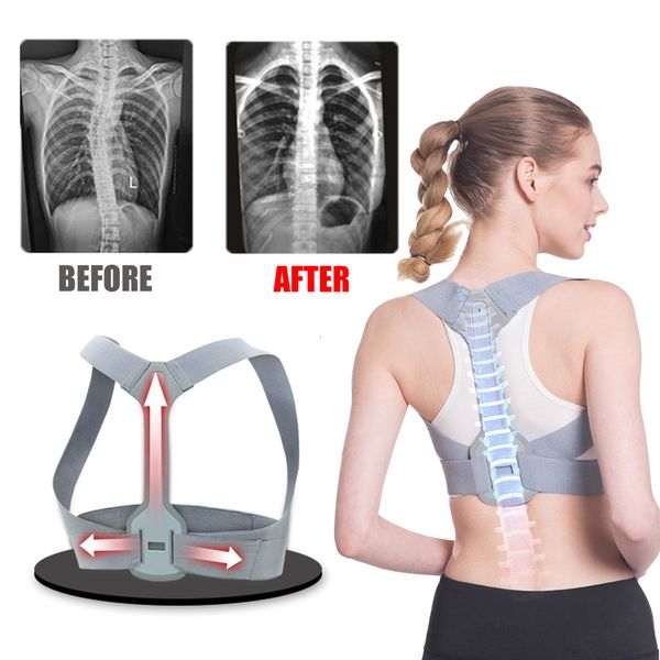 Masseur complet du corps Correcteur de posture Support d'épaule du dos Bande de correction Orthèse réglable Correction Ceinture de soulagement de la douleur à bosse Soins de santé 230909