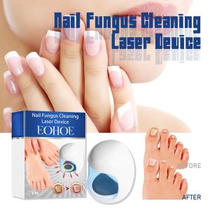 Nail Fungal Nail Laser Nail Fungus Laser Cure Machine Traitement Champignons de réparation avec ongle Onechomycosis Toenail La O9W5