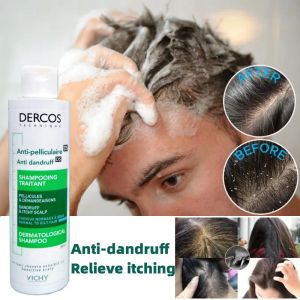 Green Label 200ml shampooing pour hommes et femmes Anti-pelliculaire contrôle de l'huile pour nettoyer les cheveux gras shampooing de soin du cuir chevelu