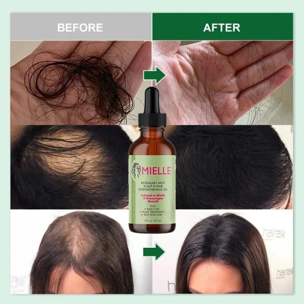 Crecimiento del cabello Aceite esencial Rosemary menta Fortalecer el aceite Nutriente tratamiento para las puntas abiertas y el cabello seco de Mielle Organics.