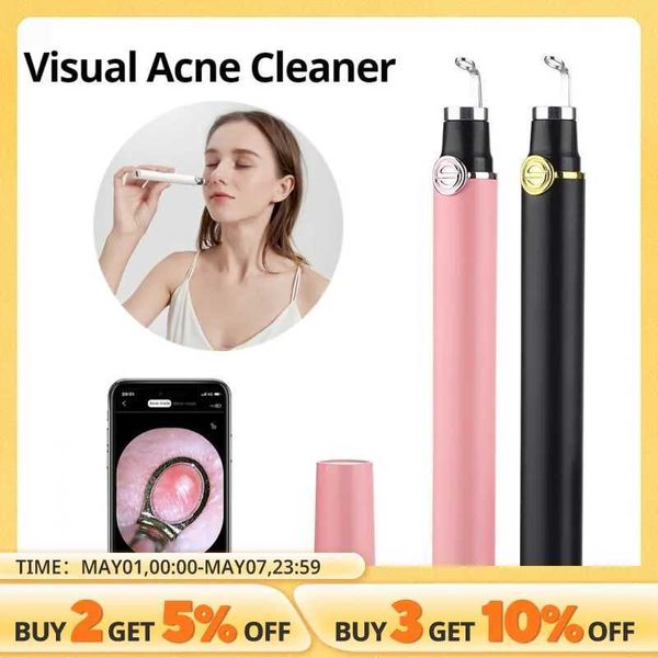 Home Beauty Instrument Intelligent Visual Acné aiguille avec 20x caméra Blackhead Cleaning Beauty Tool Extraction faciale Q240507