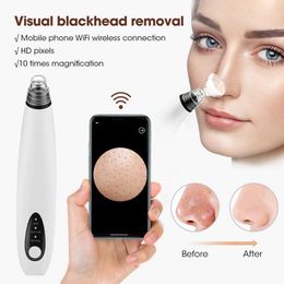 Home Beauty Instrument Visual Blackhead Remover Vacuüm gezichtsreiniging Acne Cleaner WiFi Micro Camera Black Spot Removal Skin Care Q240508