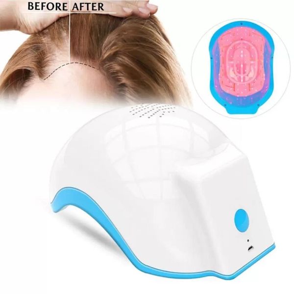 Casco con sistema de tapa láser para el crecimiento del cabello para uso doméstico, tratamiento de trasplante de cabello, 80 bombillas de diodo