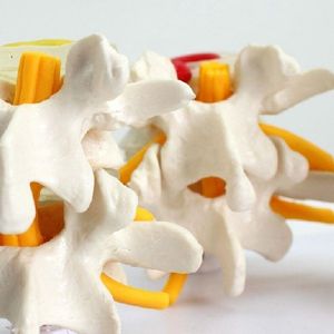 Freeshipping Menselijke Anatomie Skelet Wervelkolom 4-Stadia Lumbale Wervel Model Hersenen Schedel Traumatische Onderwijsbenodigdheden Iltcu