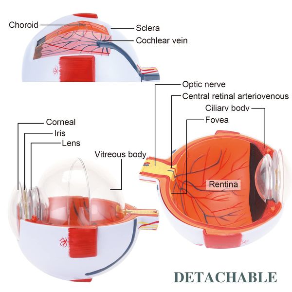 Human Eye Model 6x Agrandir avec un support amovible Modèle de globe oculaire anatomique pour l'étude de classe de sciences affichage de l'éducation médicale