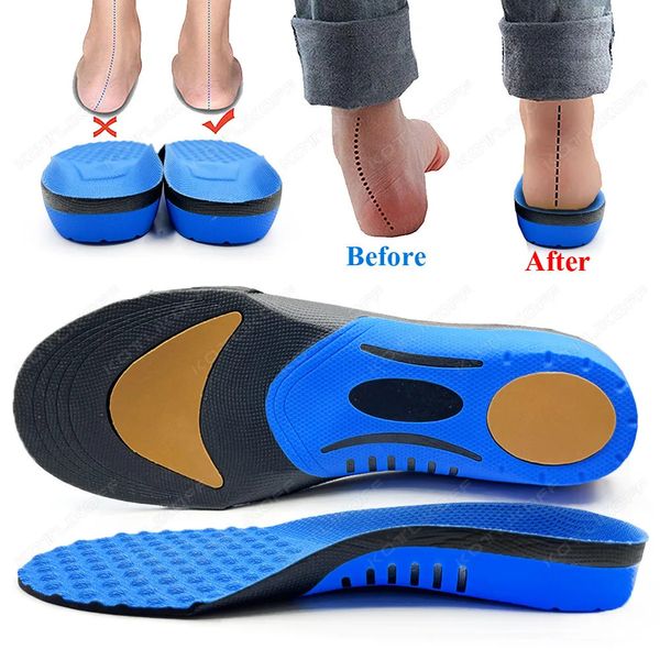 Semelles pour pieds pour pieds orthopédic Valgus Modèles de semelles intimes arc de pied plat Running Arch Support Chaussures Accessoires Insérer les hommes femmes 240329