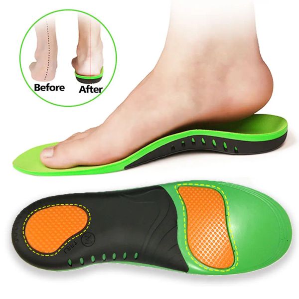 Isoles Plus Tamaño Ortótico Cubitus Varus Flat Foot Isole Isuelos ortopédicos para zapatos Insertar Arch Support Almohadilla para fascitis plantar