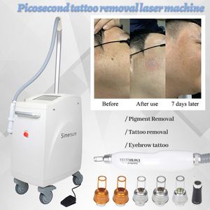 Laser Tattoo Removal Machine Yag Lazer Wenkbrauw Pigment Rimpel Verwijder Schoonheidsapparatuur