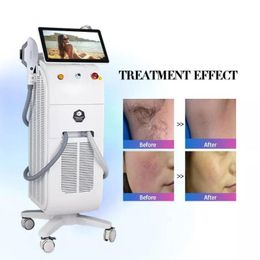 Nieuwste diode laser ontharing machine 2 handvat ijs platina titanium prijs lazer haar verwijderen salon schoonheidstoepassing