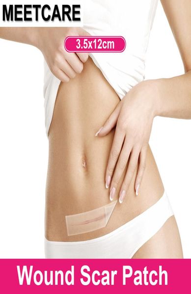 Cicatrice médicale Away Patch Silicone Gel Speille de plaie Retrait Césarienne Césarienne Hypertrophique Cicatrices de peau chéloïde Traitement de thérapie 4641429