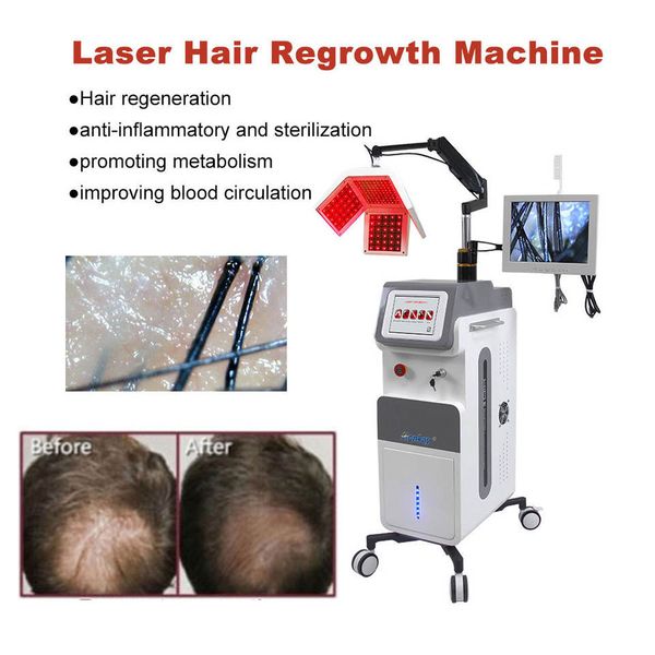 Laser à diode 650nm multifonctionnel pour la repousse des cheveux avec caméra d'analyse de la peau