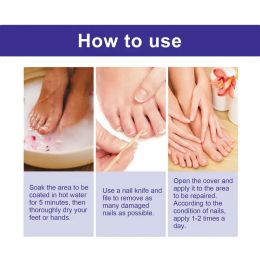Nagelreparatie essentie 10 ml zachte nagelreparatie vloeibare nagels revitaliseren vloeibare nagels bescherming gereedschap natuurlijke nagelverzorging essentie
