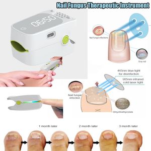 Traitements des ongles 905NM Dispositif de thérapie au laser de champignons Mini instrument indolore pour les soins des pieds Blanchiment Suppression 230908