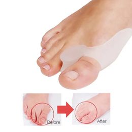 Nuevo 2pcs Silicona Gel Pulgar Corrector Bunion Little Toe Protector Separator Hallux Valgus Dostimos de algodón de alivio de cuidado del pie