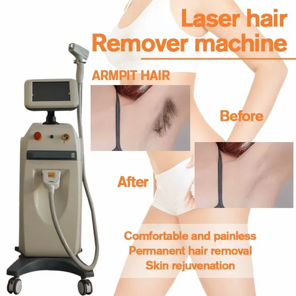Haute intensité 808Nm Lumenis Diode Laser Hair Removal Machine 808 Diode Traitement Ce/Dhl