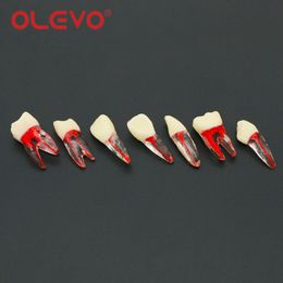 Olevo 5 PCS Bloques de endo dental Endodóntico RCT Modelo de entrenamiento de conducto radicular Archivos Pulpa Resina Dentrina Práctica Denticación Enseñanza