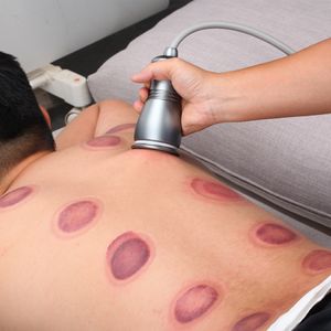 Andere Gesundheitspflegeartikel Elektrische Kratzmaschine Körperschröpfmassage Gua Sha Ventosas Anti Cellulite Fett Vakuumsaugpumpen Therapiegerät 230207
