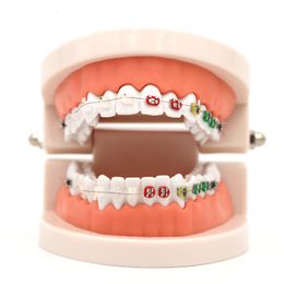 Andere orale hygiëne 1 st -tandheelkundig orthodontisch behandelingsmodel met orthopetaal keramische beugel boogdraad buccale buis ligatuurbanden tandheelkundige gereedschappen 230524