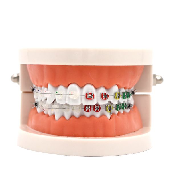 Autre hygiène bucco-dentaire 1pc modèle de traitement orthodontique dentaire avec support en céramique fil d'arc ortho métal orthodontique prothèse dentaire modèle 230617